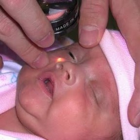 bebe-ciego1